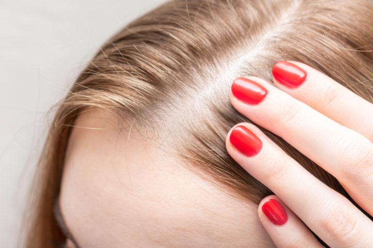 Haarausfall partnersuche