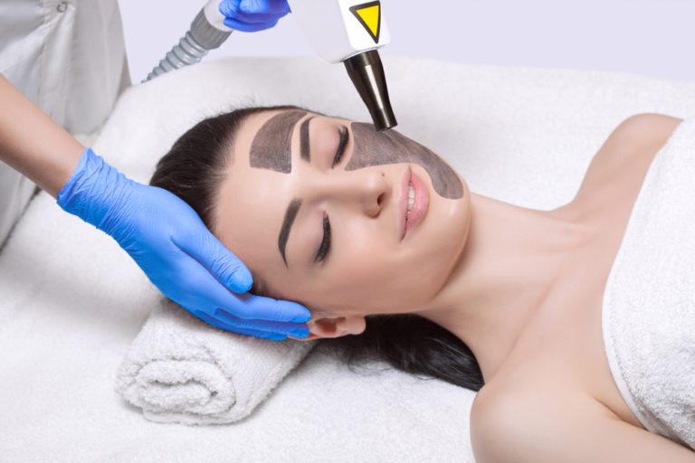 Carbon Laser Peeling: Für einen strahlenden und ebenmäßigen Teint