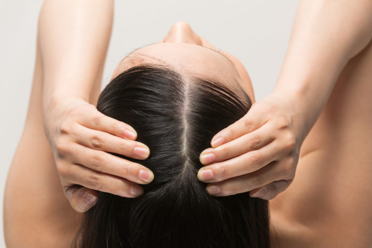 Alopezie: Was kann man gegen Haarausfall tun?