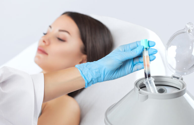 Eigenbluttherapie: Injektionen mit plättchenreichem Plasma (PRP)