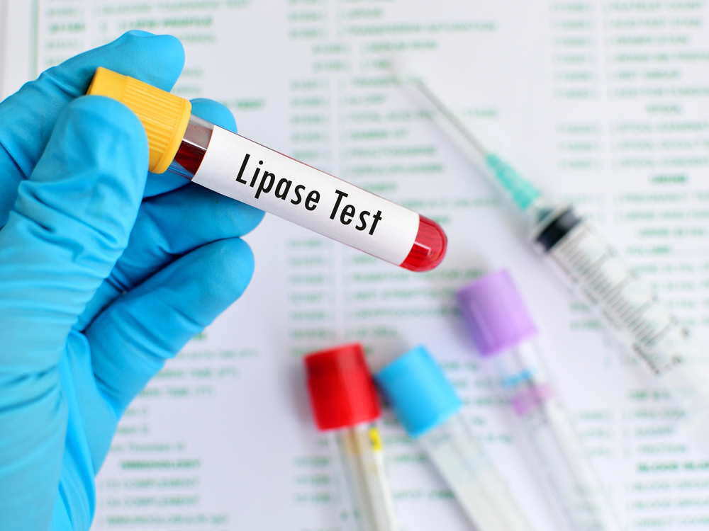 lipase wert ermitteln